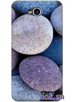 Чехол для LG L70 Dual - Морские камушки 