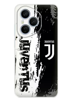 Huawei Honor 400 Pro (China) чехол - Футбол логотип Juventus Ювентус Футбольный клуб
