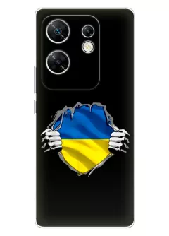 Чехол на Infinix Zero 30 для сильного духом народа Украины