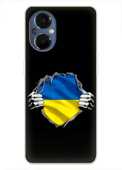 Чехол на OnePlus Nord N20 5G для сильного духом народа Украины