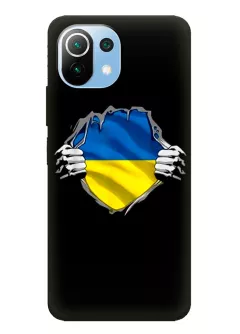Чехол на Xiaomi 11 Lite 5G для сильного духом народа Украины