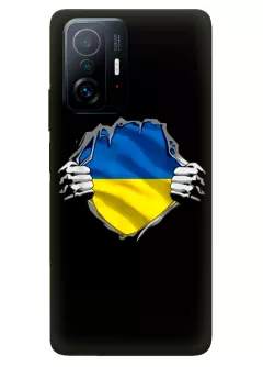 Чехол на Xiaomi 11T для сильного духом народа Украины