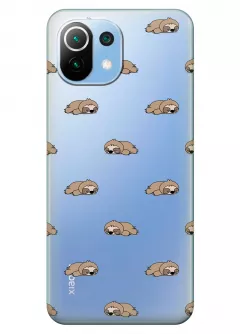 Чехол для Xiaomi Mi 11 Lite 5G - Спящие ленивцы