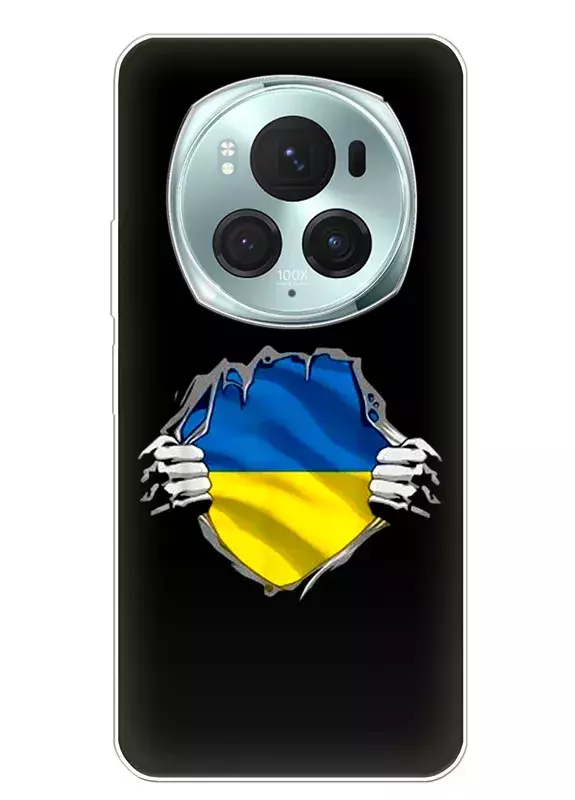 Чехол на Honor Magic 6 Pro для сильного духом народа Украины
