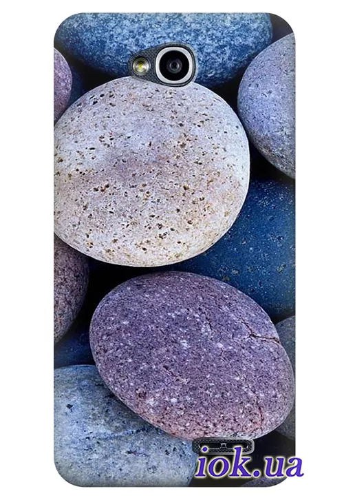 Чехол для LG L70 Dual - Морские камушки 