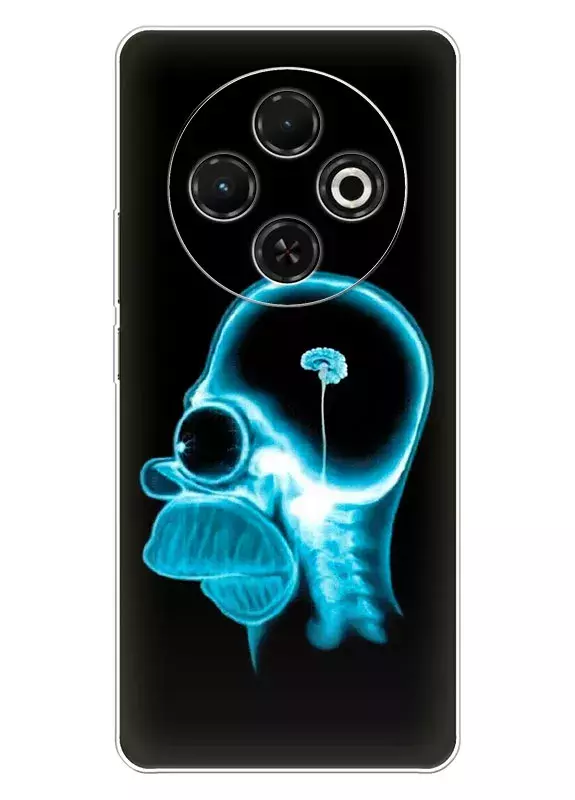 Чехол для Tecno Spark 30C - Симпсоны крошечный мозг Гомера Симпсона под рентгеном